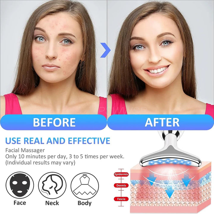 Face and Neck Lift and Anti-Wrinkle Device