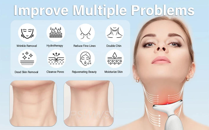 Face and Neck Lift and Anti-Wrinkle Device