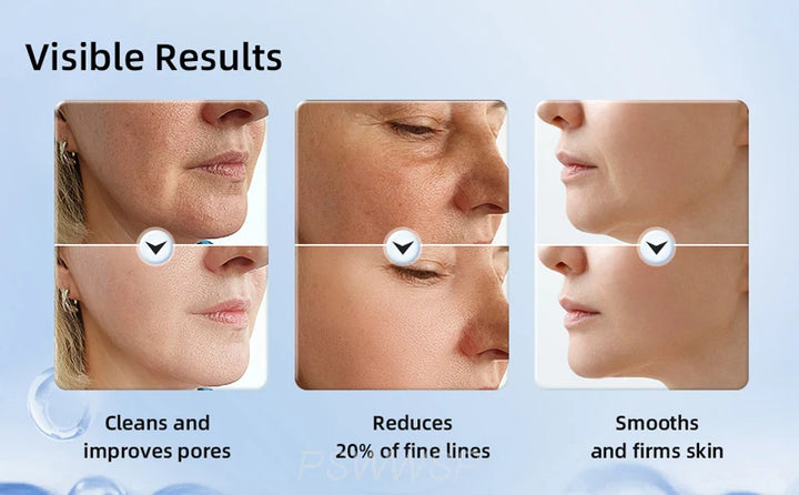 Face and Neck Lift and Anti-Wrinkle Device